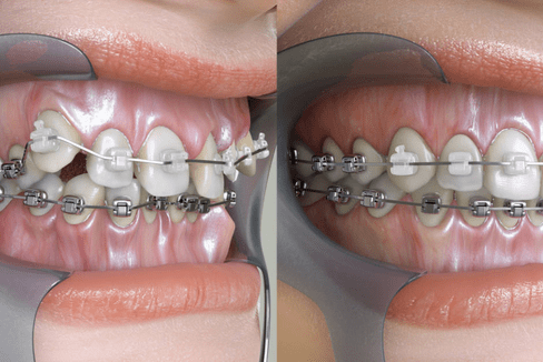 Cabinet Dentaire Dentiste Témara Dr Hakim Nuijai (1)-min